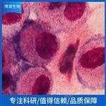 769-P人腎細(xì)胞腺癌細(xì)胞